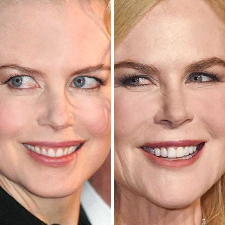 Nicole Kidman - 37 lat vs 52 lata