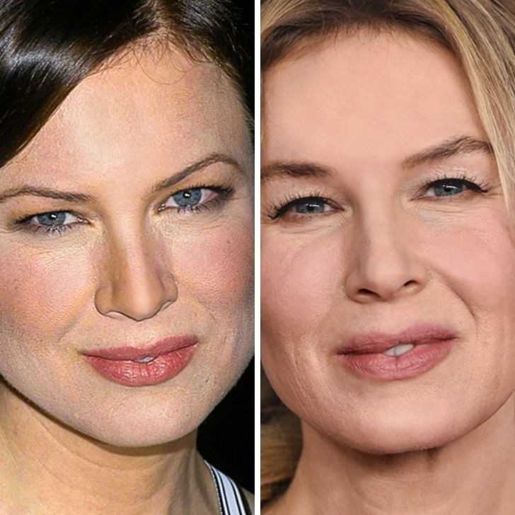 Renée Zellweger - 35 lat vs 50 lat