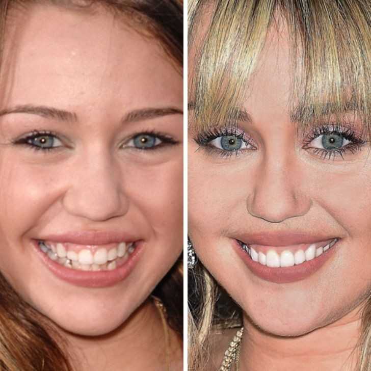 Miley Cyrus - 13 lat vs 26 lat