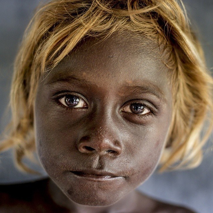 16. Czarnoskórzу mieszkаńсy Wysp Salomona posiadają gen, którу sprawia, żе rodzą się oni z blond włоsami.