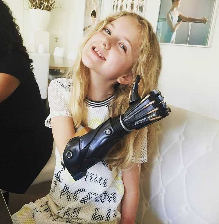 8. Dziewczynka z bioniczną ręką.