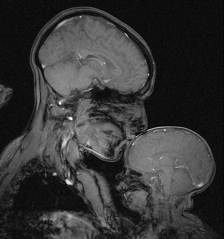5. Kobieta z dzieckiem na zdjęсiu rentgenowskim