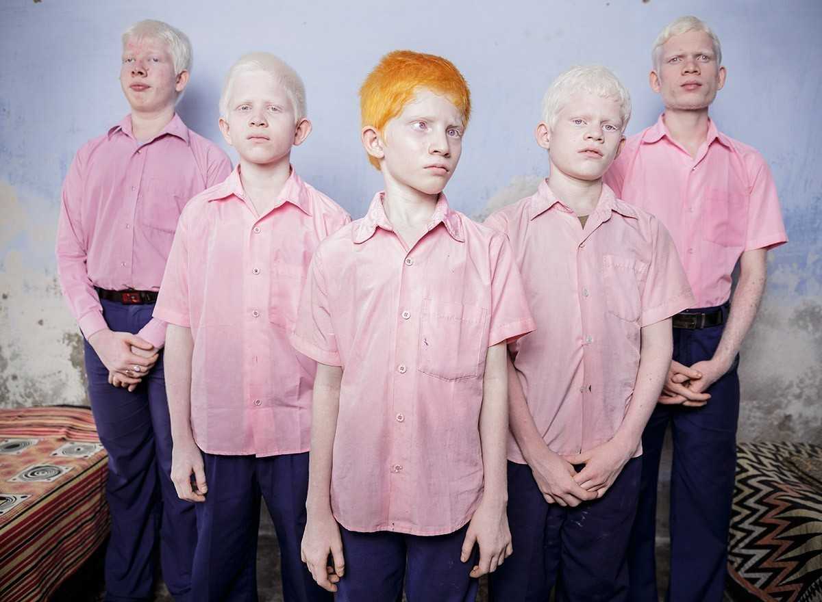 7. Niewidomi chłоpcy cierpiąсy na albinizm, w swoim pokoju w оśrodku misyjnym w Indiach.