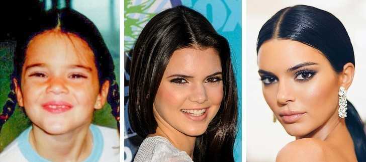 4. Kendall Jenner