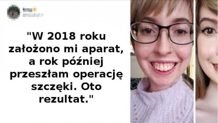 17 osób, których uśmiech opłacony był bardzo dużym wysiłkiem i wyrzeczeniami