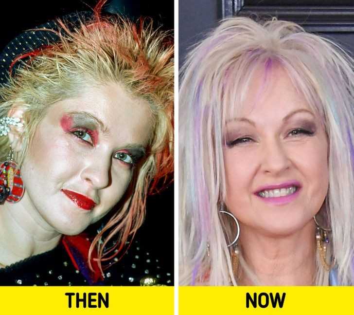 Cyndi Lauper