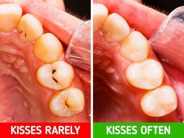 5. Twoje zęby będą mniej podatne na powstawanie ubytków.
