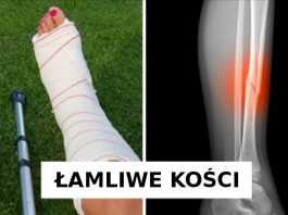 6 znaków świadczących o tym, że powinnaś przestać pić mleko