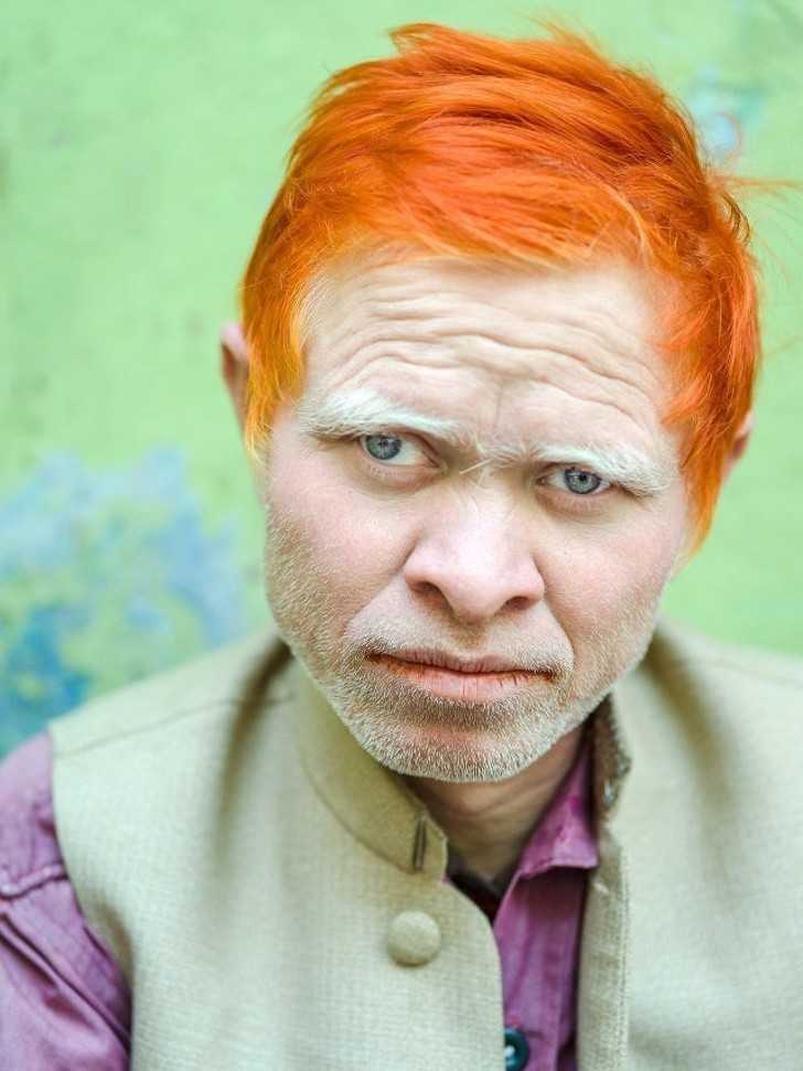 1. Albinos w Indiach