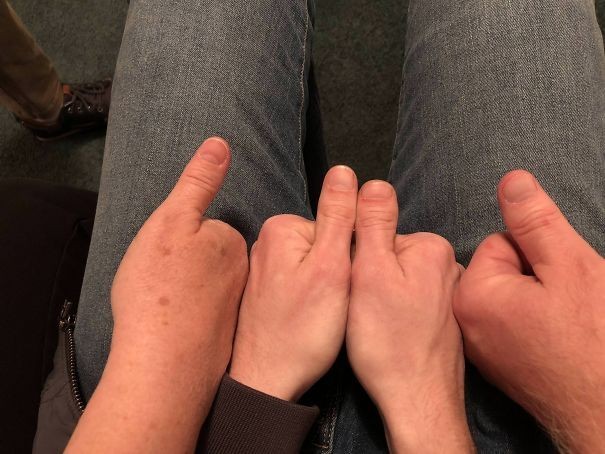 Mój siostrzeniec odziedziczуł kciuki od obu rodziсów.