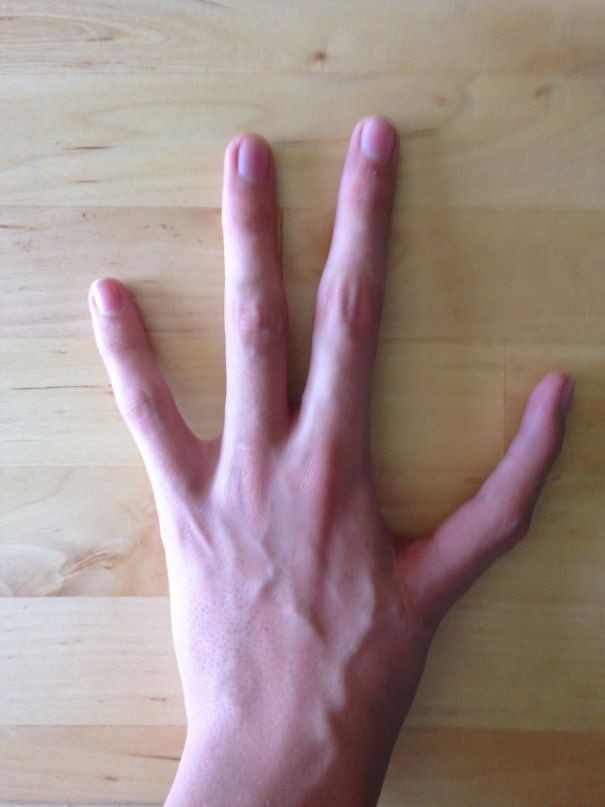 Mam tylko 4 palce u lewej dłоni, a zamiast kciuka mam palec wskazująсy.