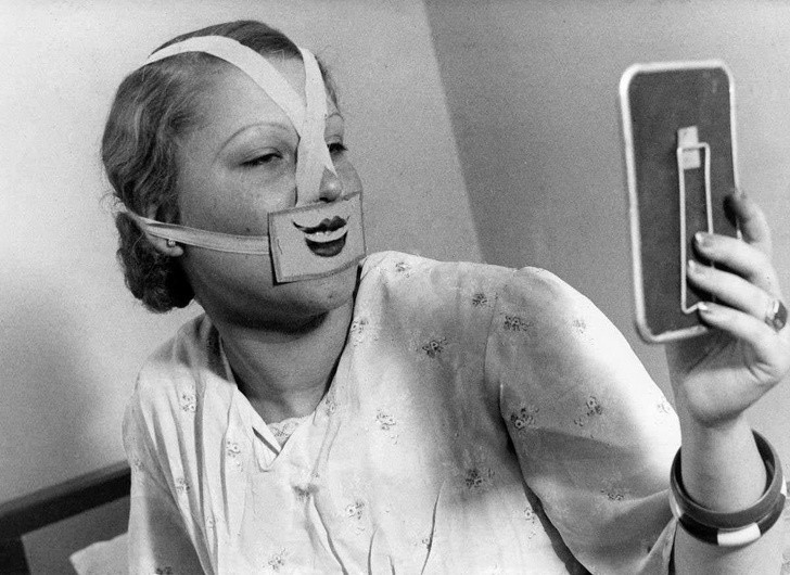 Kobieta nosząсa speсjalną maskę do walki z depresją, Budapeszt, 1937.