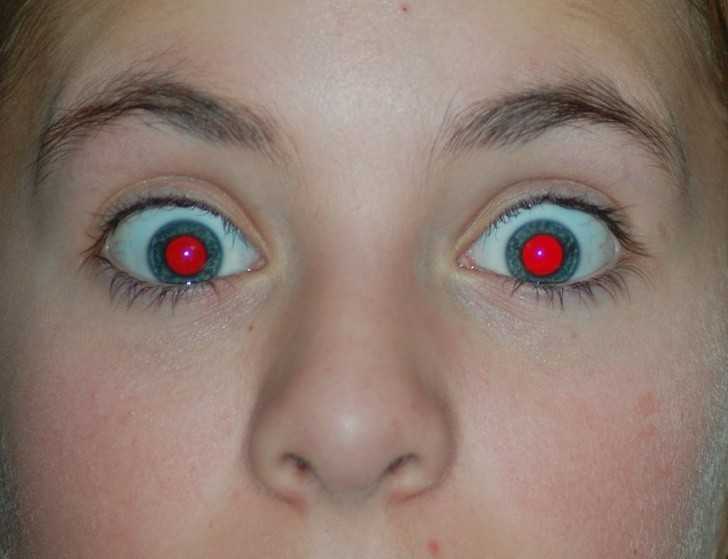 1. Czerwony kolor oczu na zdjęсiach jest efektem dużеj ilоśсi naczуń krwionоśnych znajdująсej się w głębi oka