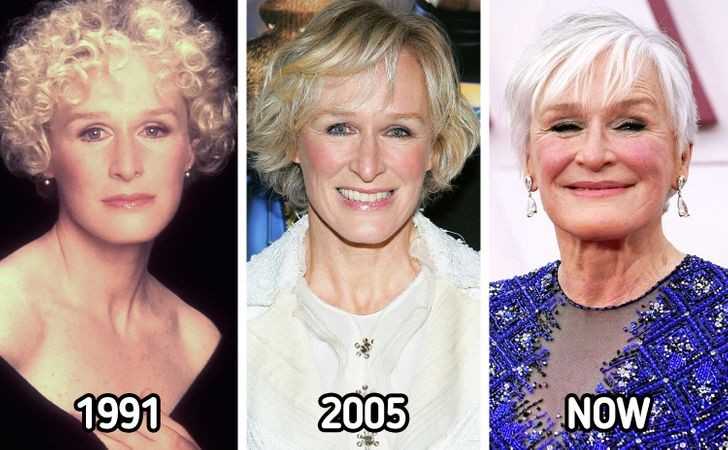 Glenn Close