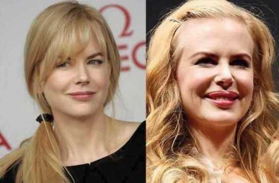 9. Nicole Kidman