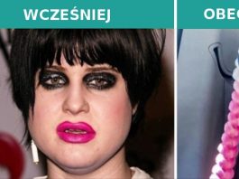 13 gwiazd, które przeszły diametralną zmianę wizerunku. Wyszło im  na dobre