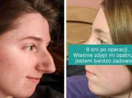 Zdjęcia przed i po, pokazujące, że zmiana małego detalu potrafi zrobić ogromną różnicę