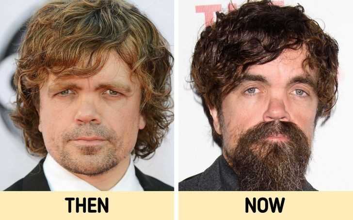 Peter Dinklage