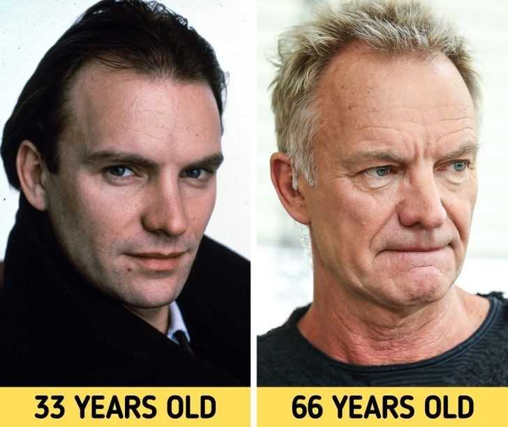 Sting