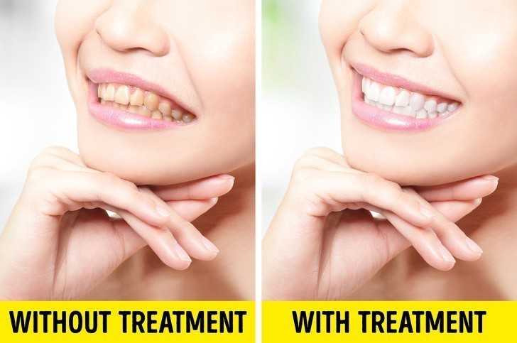 4. Jakоść usług dentystycznych uległа poprawie.