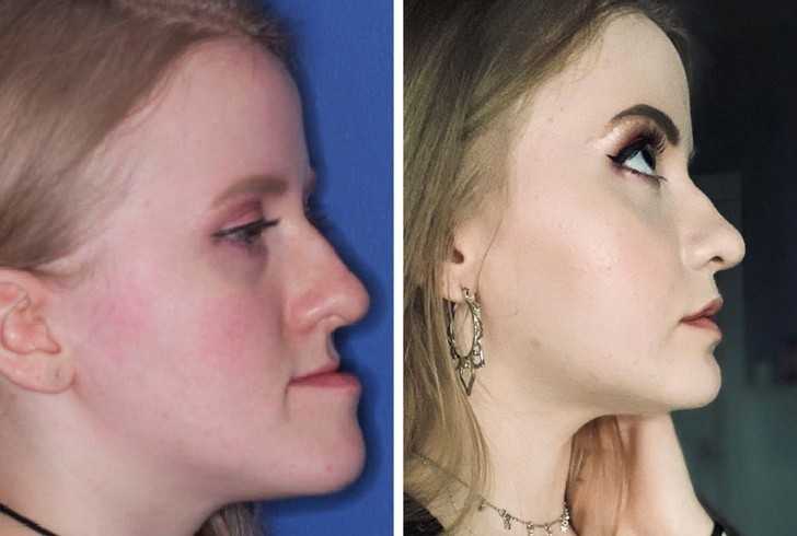 14.