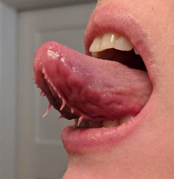 13. Mam