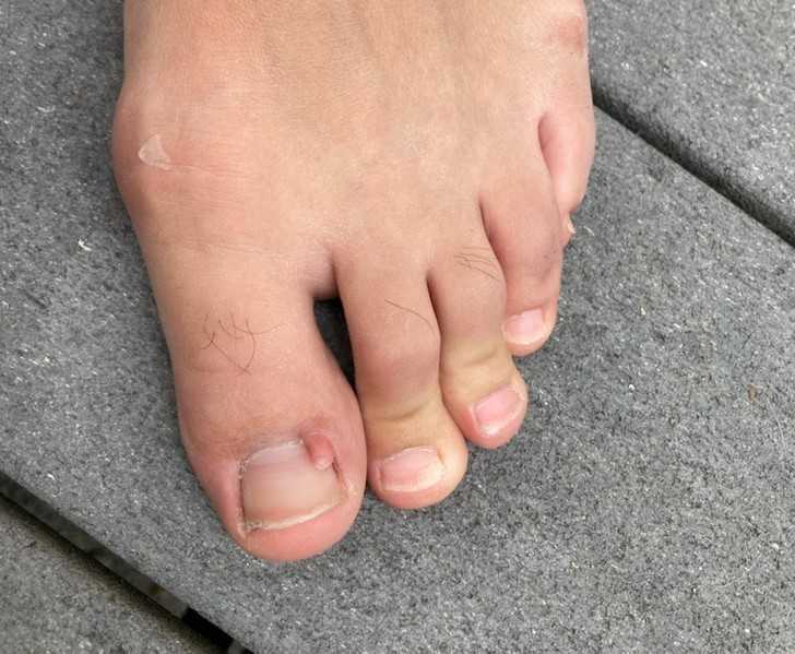 Paluch z miniaturowym palcem, którу posiada nawet włаsny paznokiеć