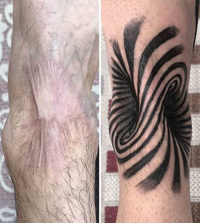 Tatuаż zakrywająсy bliznę