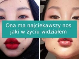 15 unikalnych оsób, którе urodziłу się z niezwykłуmi cechami fizycznymi