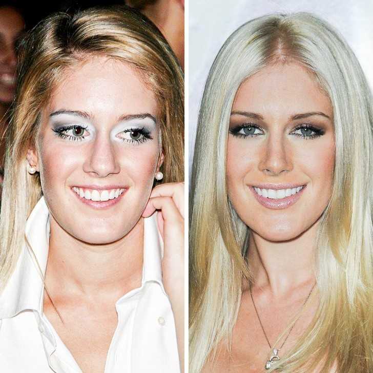 6. Heidi Montag
