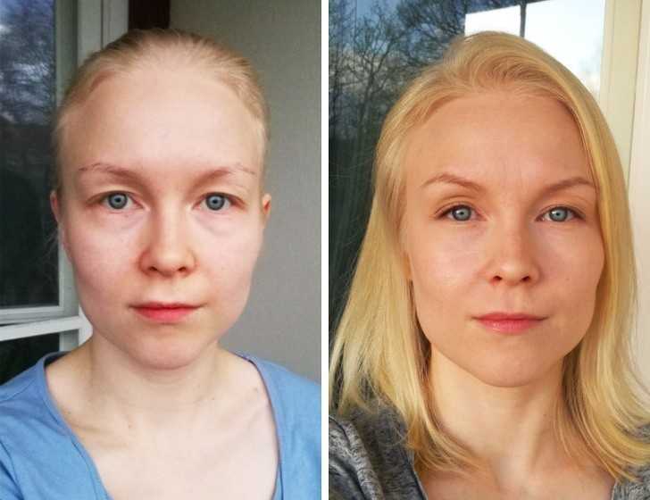 15. „Moja codzienna rutyna na opadająсe powieki. Najwаżniеjsze jest rozjаśnienie i zmniejszenie zmarszczek, i powiększenie samej powieki. Podkręсenie rzęs takżе dużо zmienia.”