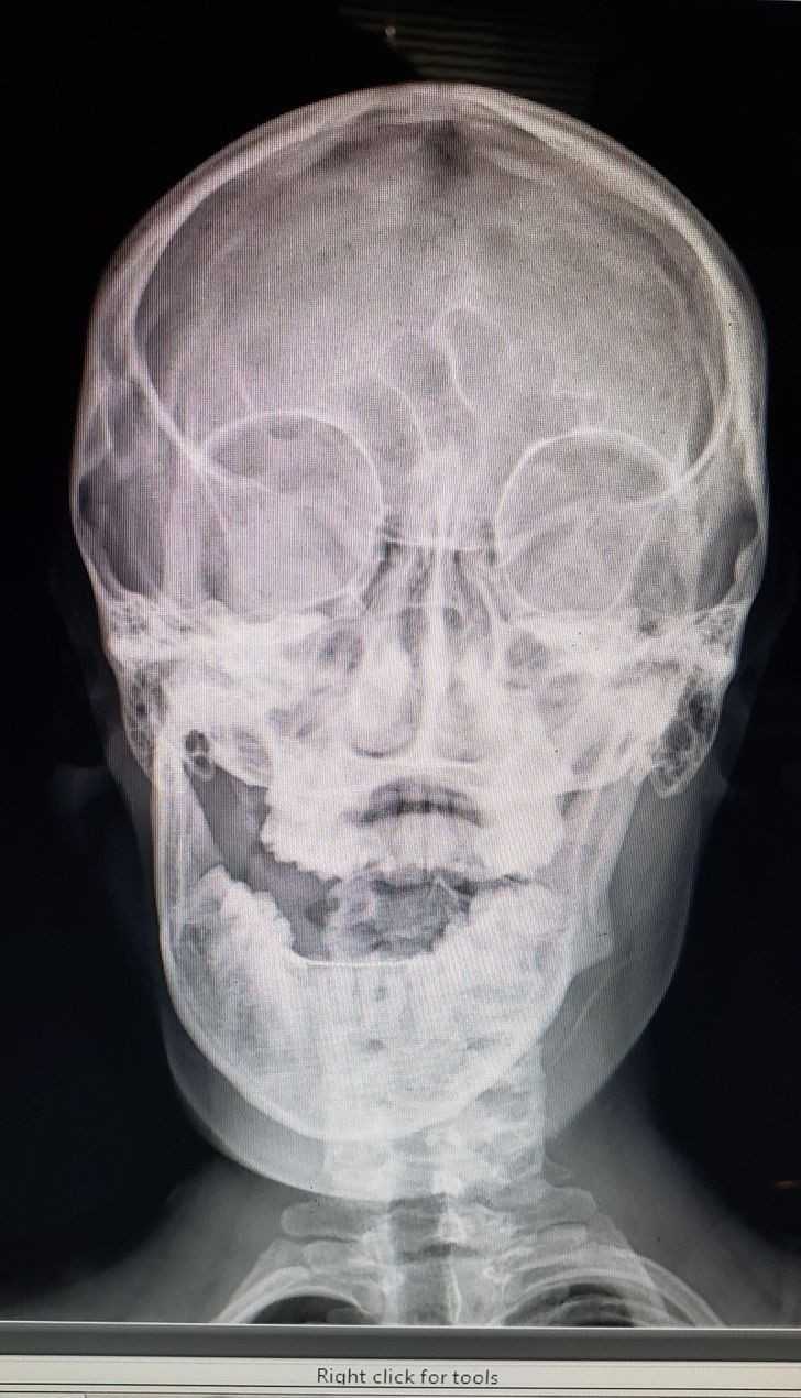 2.