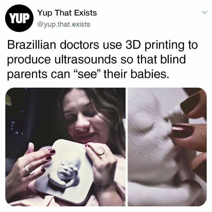 Brazylijscy lekarze wykorzystują technologię drukowania 3D przy badaniach USG, by niewidomi rodzice mogli 