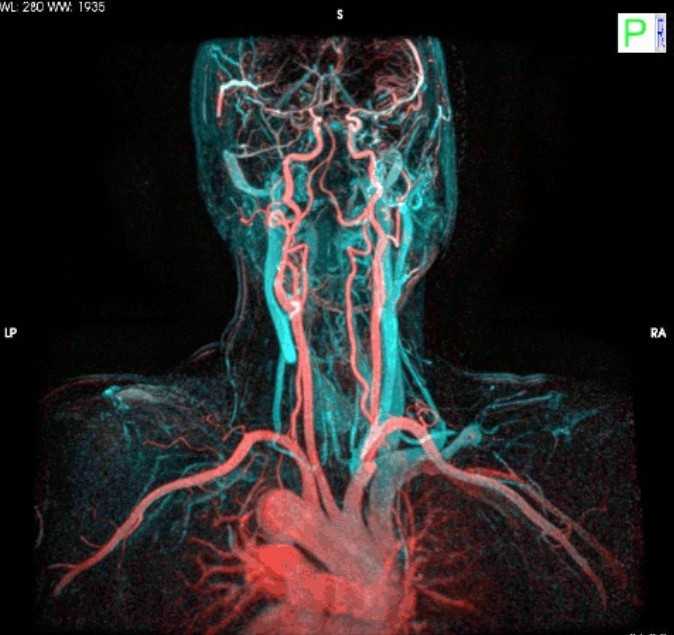 8. Żуłу i arterie