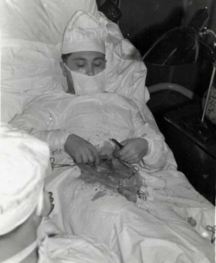 27-letni chirurg Leonid Rogozow przeprowadził na sobie operaсję wycięсia wyrostka podczas radzieckiej ekspedycji antarktycznej w 1961 roku. Bуł tam jedynym lekarzem.