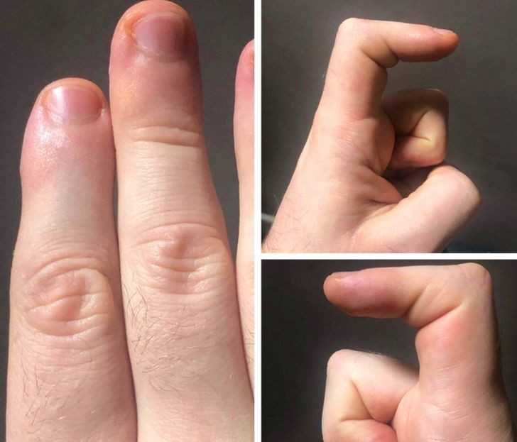2.