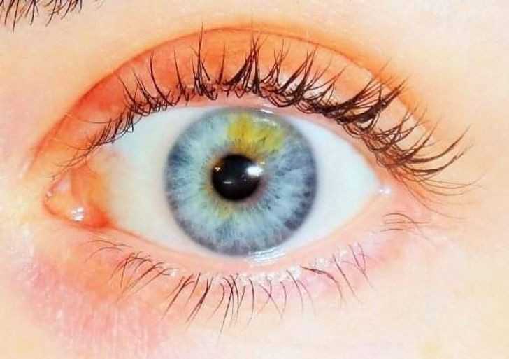 10.