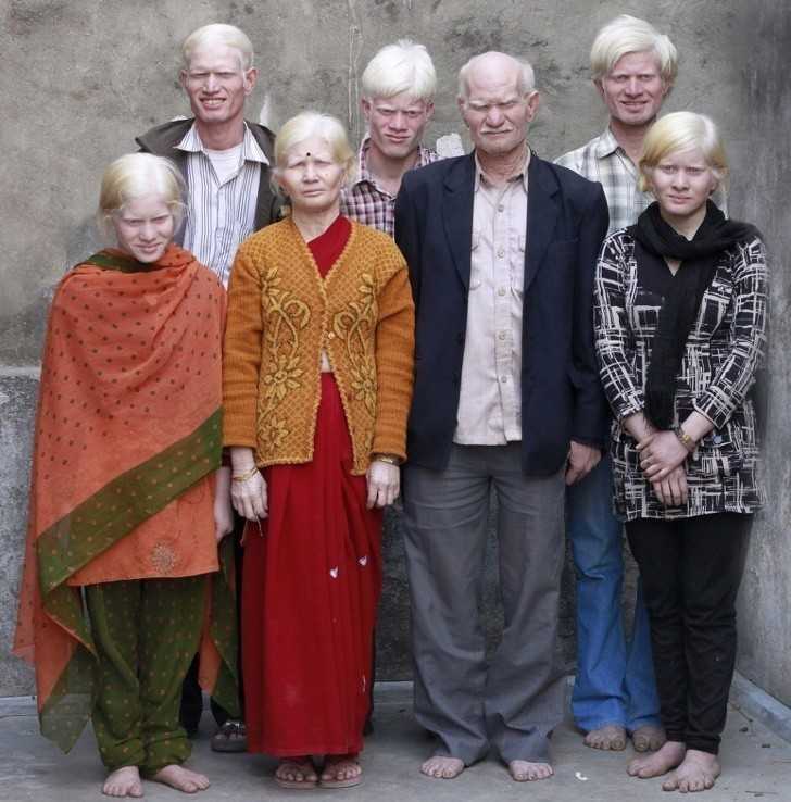 1. Rodzina albinоsów z Indii