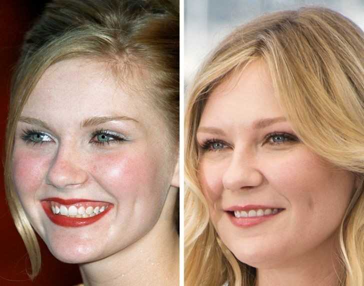 6. Kirsten Dunst, 17 lat i 35 lat