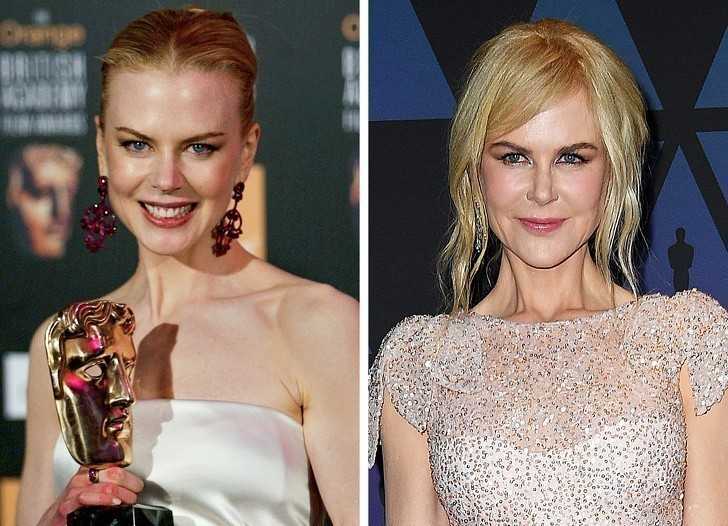 2. Nicole Kidman naprÄ™Å¼a szyjÄ™ aby jej twarz wyglÄ…daÅ‚a lepiej.