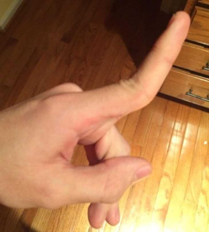 15. "Moje palce wyginajÄ… siÄ™ w drugÄ… stronÄ™!"