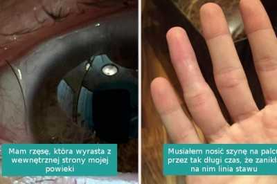 15 osób, które znalazÅy coÅ interesujÄ
cego i postanowiÅy podzieliÄ siÄ ze Åwiatem